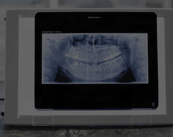 refertazione odontoiatrica online